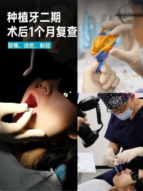 广州口腔医院种牙怎么样？效果和价格如何？-图2