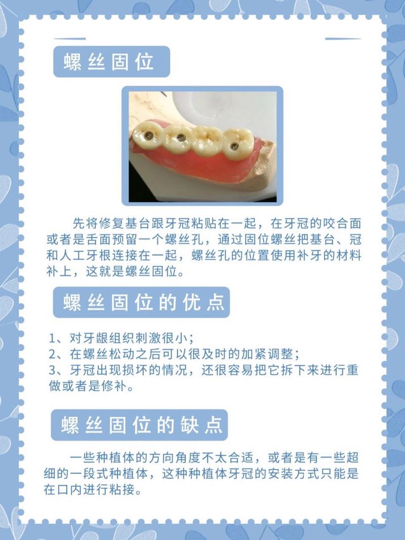 种牙装牙冠步骤图片能清晰展示每一步吗？-图1