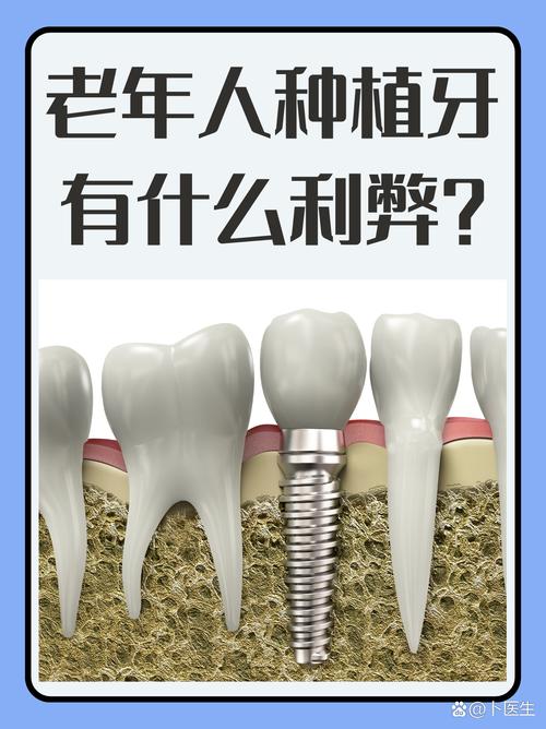 60岁是否还能种牙-图2