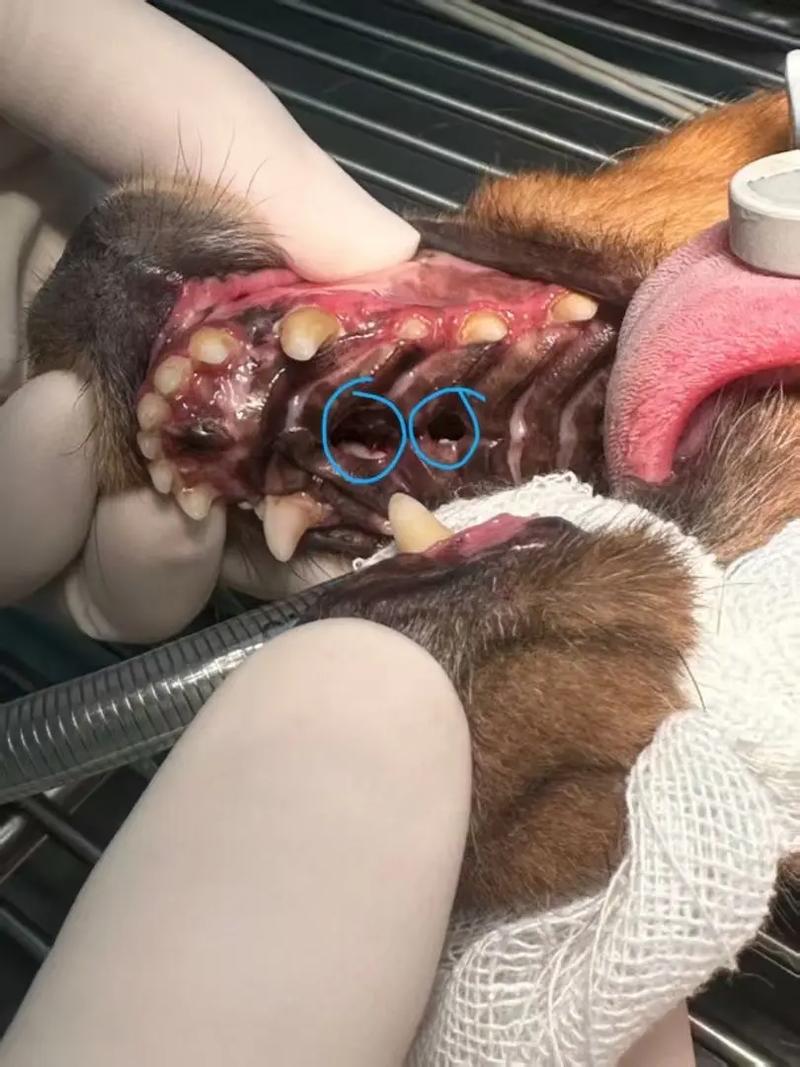 上颌骨缺损修复方法有哪些临床选择与应用策略?-图1 上颌骨缺损修复方法有哪些临床选择与应用策略?-图1