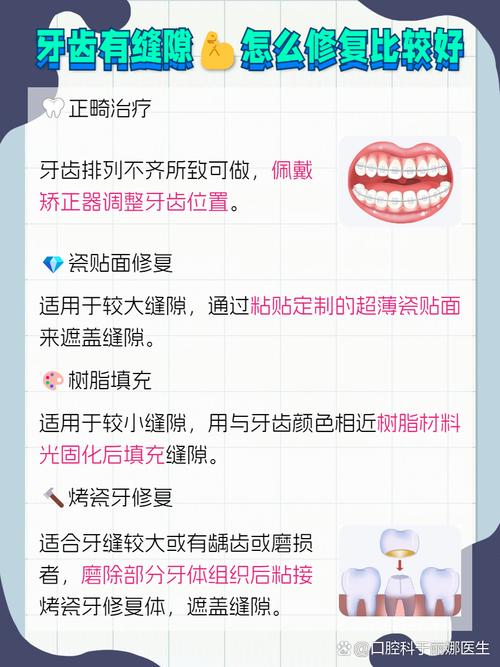 补牙缝最简单的方法是什么?哪种最省时省力?自己能做吗?-图1 补牙缝最简单的方法是什么?哪种最省时省力?自己能做吗?-图1