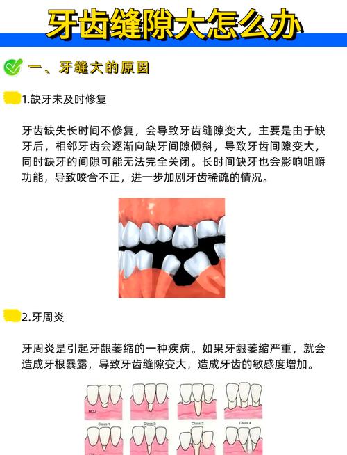 补牙缝最简单的方法是什么?哪种最省时省力?自己能做吗?-图3 补牙缝最简单的方法是什么?哪种最省时省力?自己能做吗?-图3