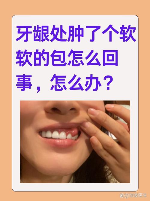 种牙后肿胀一般持续多少天?-图2 种牙后肿胀一般持续多少天?-图2