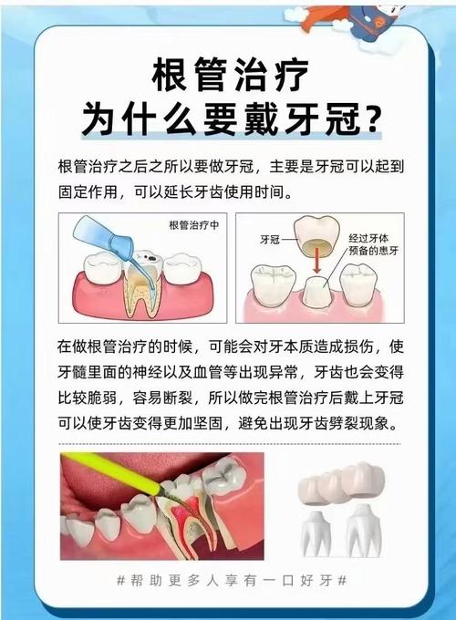 种牙后做牙冠需要多长时间?全流程各阶段时间安排及说明-图1 种牙后做牙冠需要多长时间?全流程各阶段时间安排及说明-图1