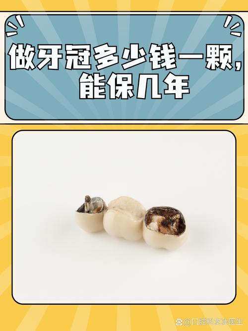 种牙后做牙冠需要多长时间？全流程各阶段时间安排及说明-图3