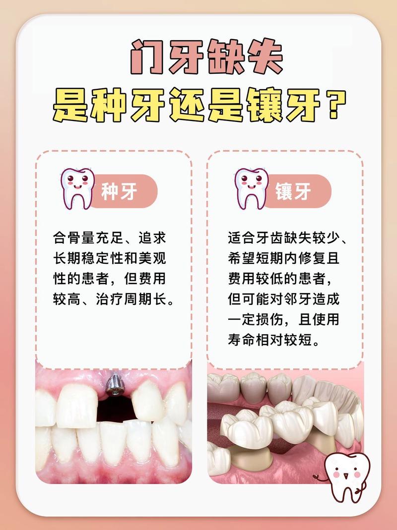 镶牙和种牙哪个更好？建议如何选择？-图2