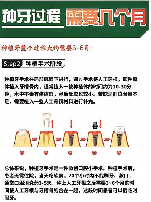 种牙后需要经常护理吗?日常维护该怎么做?-图3 种牙后需要经常护理吗?日常维护该怎么做?-图3