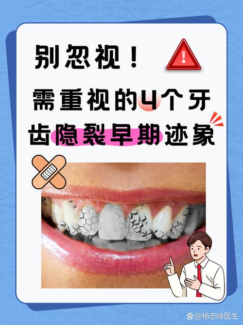 正畸牙齿后为何不能吃东西？饮食限制何时能解除？-图2