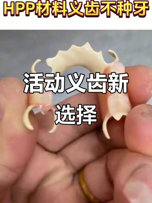 活动性义齿如何正确保存？-图1