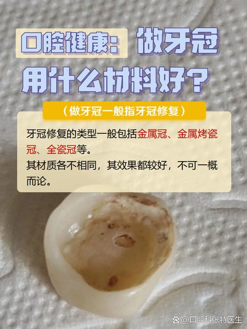 种牙后牙冠制作要多久？一般需要多长时间？-图2