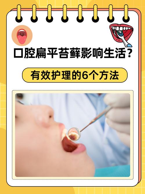 治扁平苔藓最好方法是什么？-图2