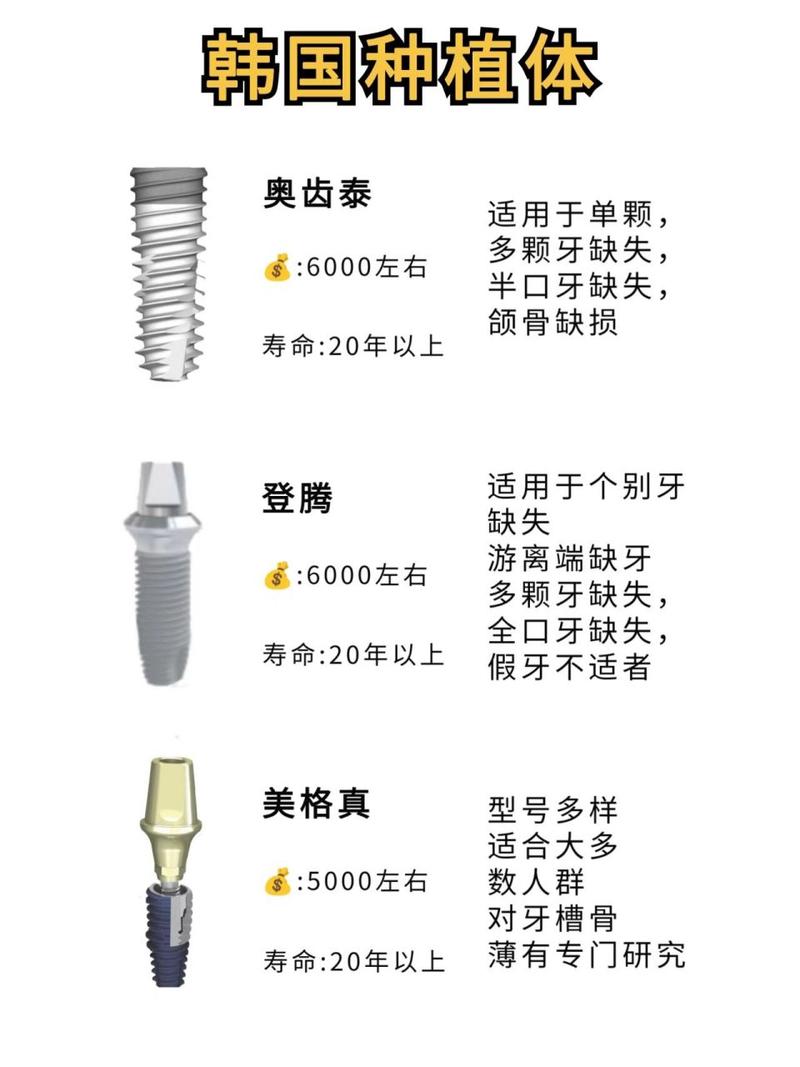 韩国最好的种牙品牌-图1