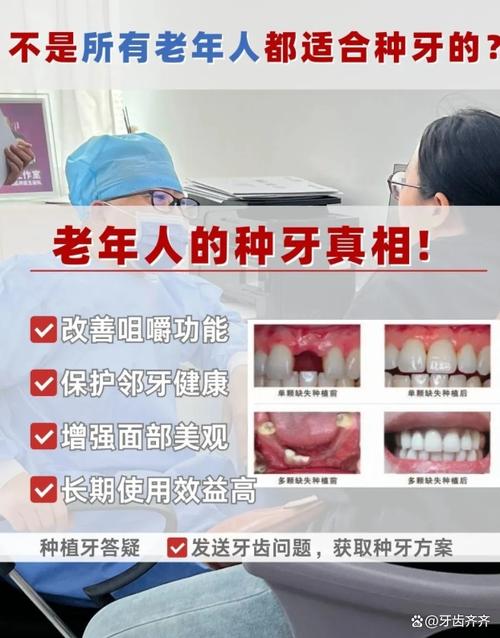 60多岁种牙有年龄限制吗?种植条件需注意哪些?-图2 60多岁种牙有年龄限制吗?种植条件需注意哪些?-图2