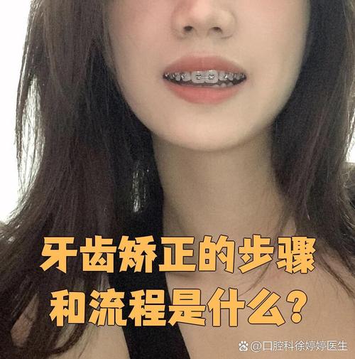 50岁牙齿矫正可行吗？有哪些适合的方法？-图1