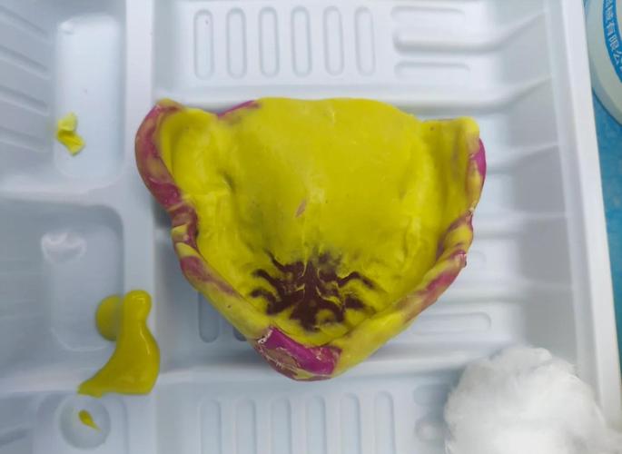 如何制作口腔托盘?详细步骤、材料准备及注意事项有哪些?-图1 如何制作口腔托盘?详细步骤、材料准备及注意事项有哪些?-图1