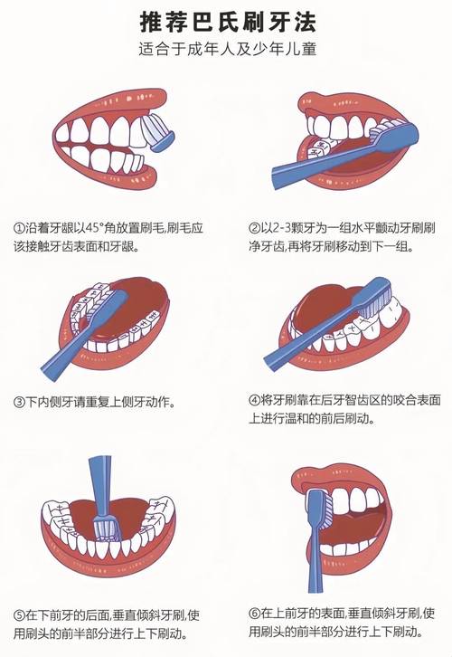 牙齿除烟渍的最佳方法究竟是什么?到底如何选择最有效的?-图3 牙齿除烟渍的最佳方法究竟是什么?到底如何选择最有效的?-图3