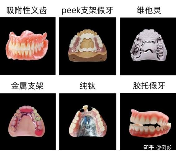 北京种牙哪里好？求推荐靠谱医院医生？-图2