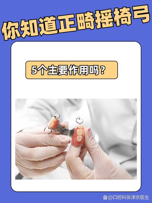 正畸摇椅弓弯制方法具体步骤是怎样的?技巧与要点解析-图2 正畸摇椅弓弯制方法具体步骤是怎样的?技巧与要点解析-图2