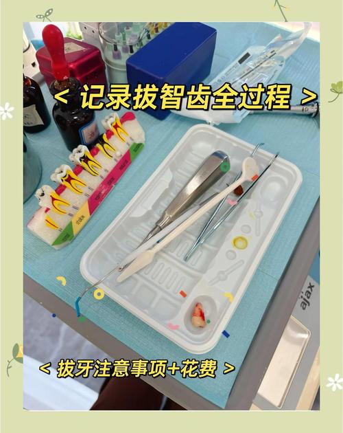 智齿肿痛怎么快速消肿?最快有效方法有哪些?-图1 智齿肿痛怎么快速消肿?最快有效方法有哪些?-图1