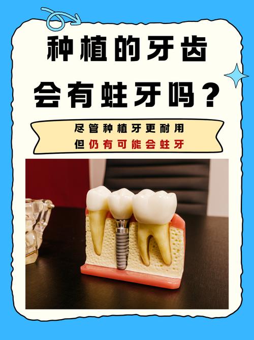 牙医为何热衷于种植牙?技术、需求与职业驱动因素分析-图3 牙医为何热衷于种植牙?技术、需求与职业驱动因素分析-图3