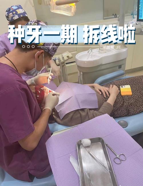 种牙术后拆线前能运动吗？这些注意事项要知晓-图1