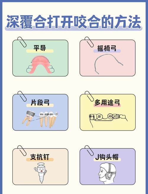 正畸有哪些辅助方法？常见类型及作用有哪些？-图2