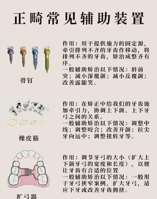 正畸有哪些辅助方法?常见类型及作用有哪些?-图1 正畸有哪些辅助方法?常见类型及作用有哪些?-图1