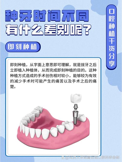 种完牙多久可以正常活动？恢复期需注意哪些事项？-图2