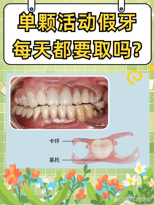 种完牙多久可以正常活动？恢复期需注意哪些事项？-图3