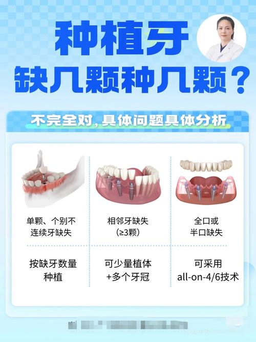 种牙是几颗一起种吗-图1 种牙是几颗一起种吗-图1