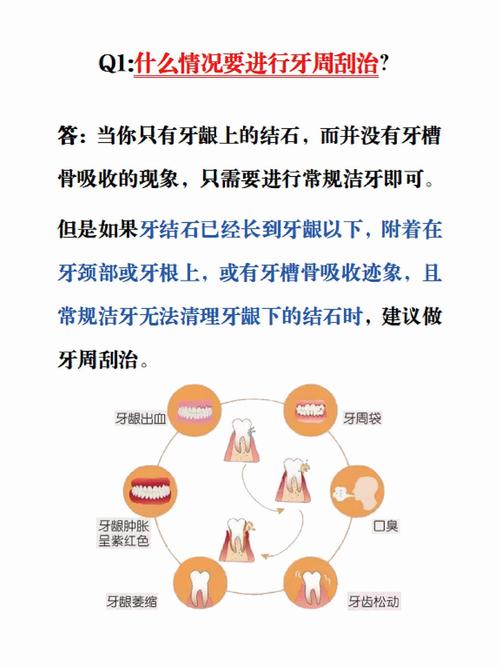 牙齿治疗的方法种类有哪些？-图3