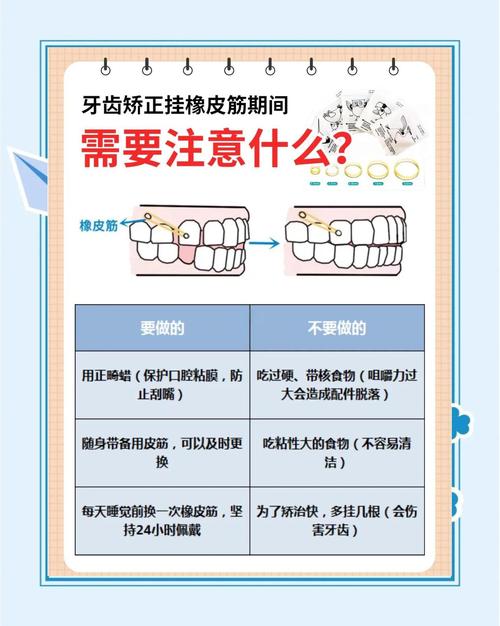正畸为何要挂皮筋？作用原来这么关键！-图1