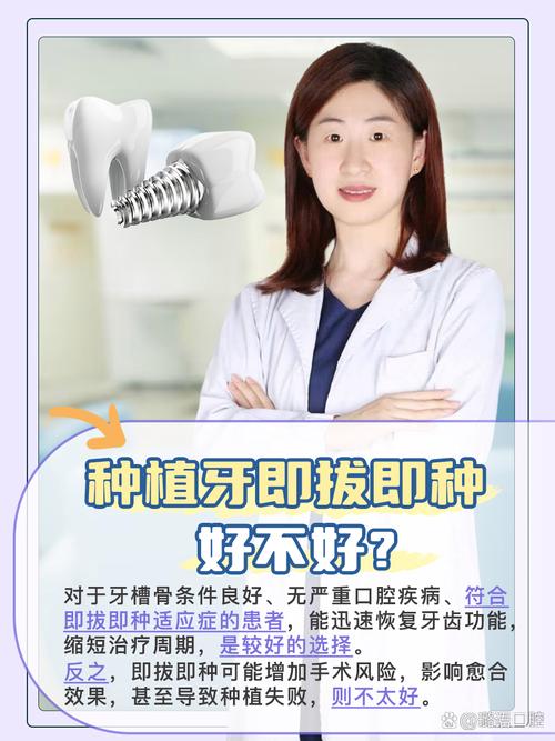 即种即拔即种牙真的好吗?-图1 即种即拔即种牙真的好吗?-图1