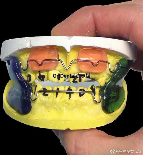 肌功能矫治器正畸图片能直观展示哪些不同矫正作用、效果及适用人群？-图3