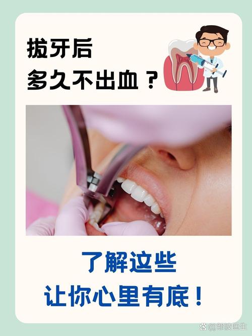 拔牙后如何正确止血？口腔止血方法有哪些？-图2