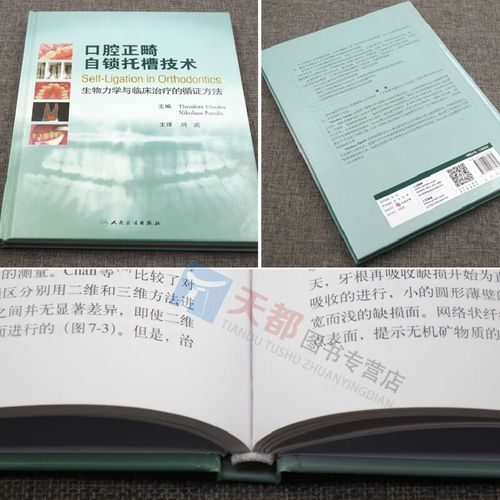 口腔正畸力学书籍，如何将力学原理转化为临床矫治力呢？-图1
