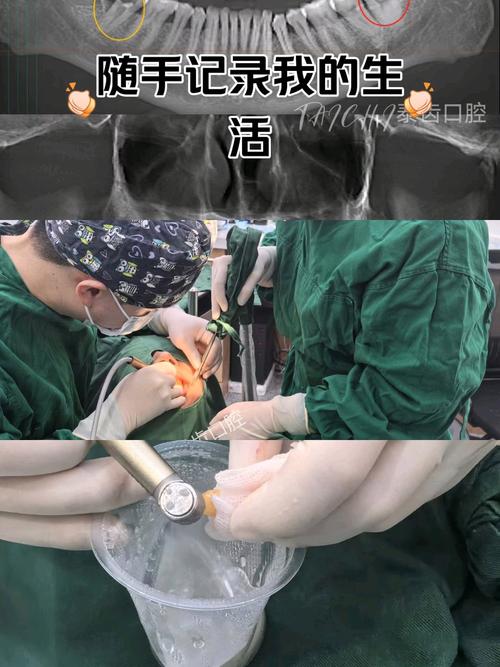 种牙填充能抬高牙床吗？具体操作步骤有哪些？-图1