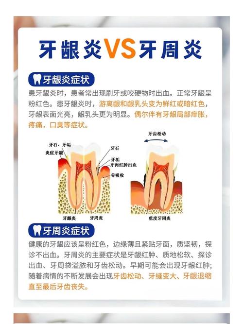 牙周炎患者种牙失败，背后究竟有哪些关键原因？-图2