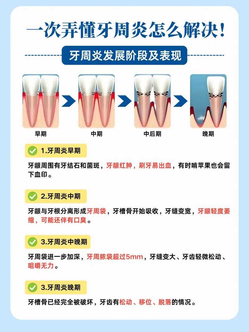 牙周炎患者种牙失败，背后究竟有哪些关键原因？-图1