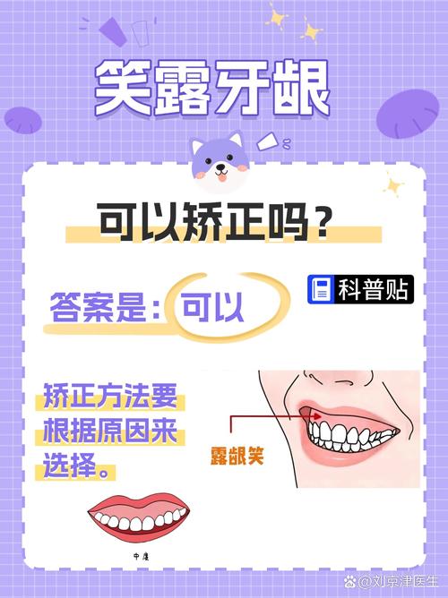 正畸前必须先治牙周吗?-图1 正畸前必须先治牙周吗?-图1