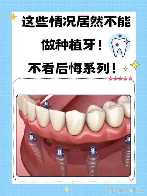 牙齿高了不能种牙,究竟是为什么?-图1 牙齿高了不能种牙,究竟是为什么?-图1