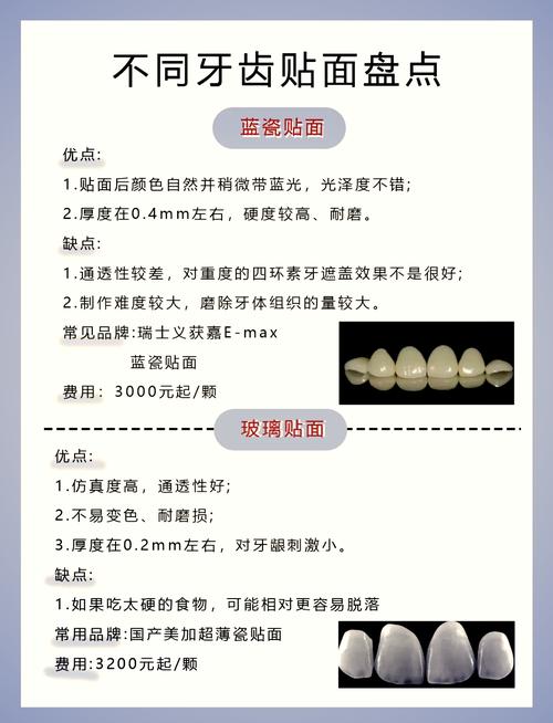 牙贴面真有100种做法？哪种最适合你？-图3