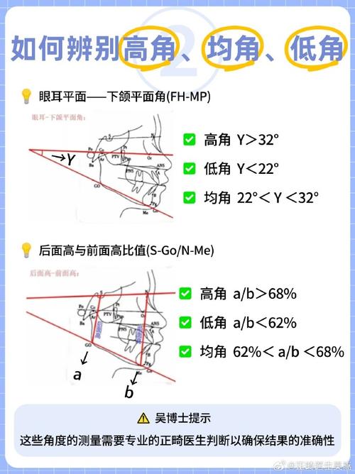 正畸研究生高角病例PPT研究重点与难点是什么？-图2