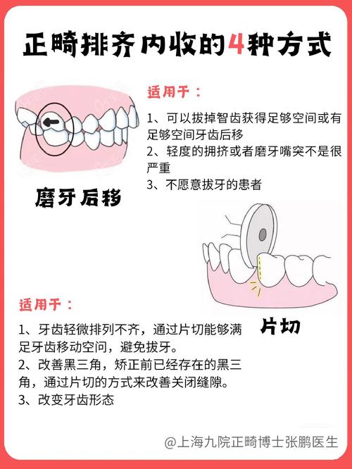 口腔内提升常用方法有哪些？如何根据情况选择合适的方法？-图3