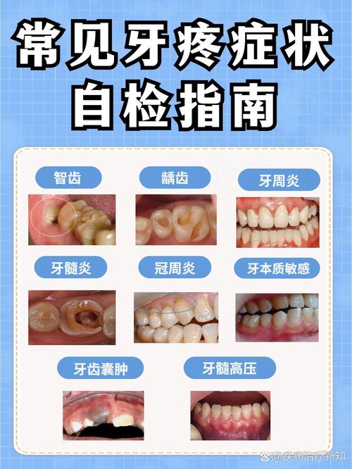 牙疼发作时如何及时止痛?快速缓解的有效方法有哪些?-图1 牙疼发作时如何及时止痛?快速缓解的有效方法有哪些?-图1