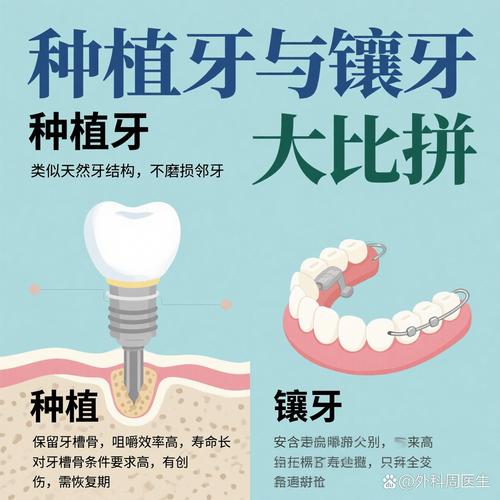 种牙镶牙纠结选?哪种更适合你?-图2 种牙镶牙纠结选?哪种更适合你?-图2