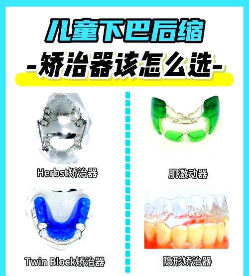 西湖巴尔正畸牙托效果如何？-图3