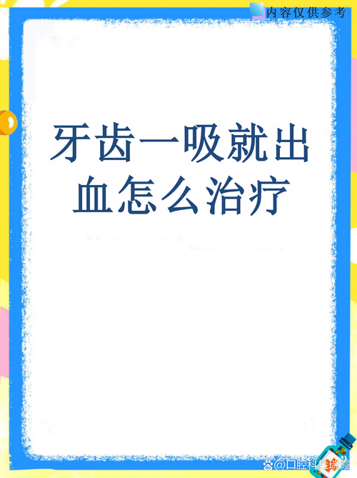 牙齿出血有哪些有效治疗方法？如何科学应对与护理？-图2