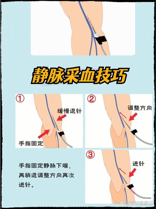 临床不同类型疾病常用的血运重建方法各有何具体适应证与选择策略?-图2 临床不同类型疾病常用的血运重建方法各有何具体适应证与选择策略?-图2
