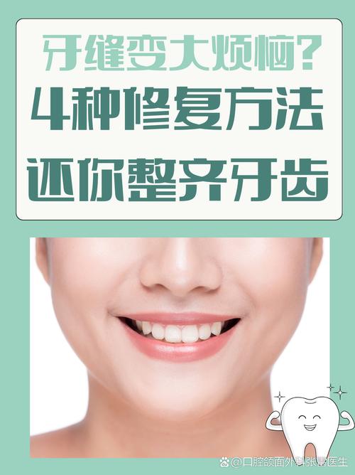 牙缝大修复该挂正畸科吗？-图2